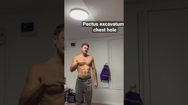 'Pectus excavatum #chest #pectus #pectusexcavatum #chesthole #bodypositivity #confidence #gym'