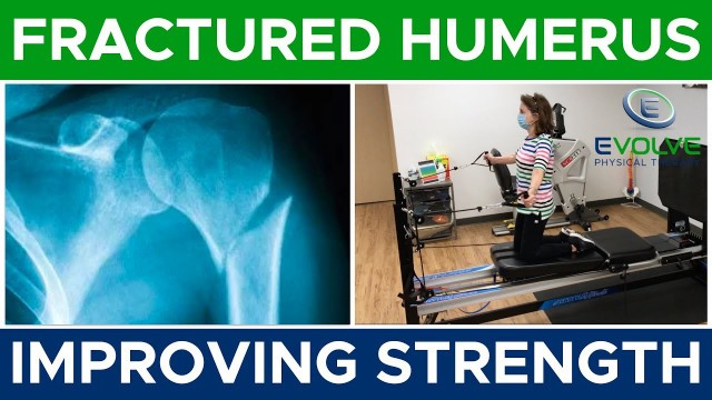 'Fractured Humerus | Improving Strength | Part 3'