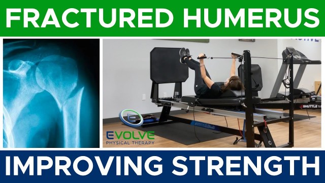 'Fractured Humerus | Improving Strength | Part 1'