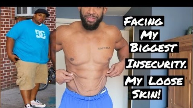 'Loose skin insecurities - 140lb weight loss - facing my fear'